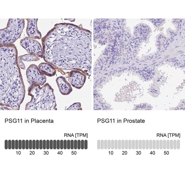 Anti-PSG11 antibody produced in rabbit