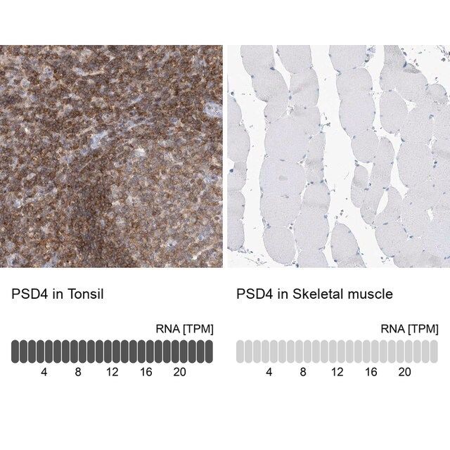 Anti-PSD4 antibody produced in rabbit
