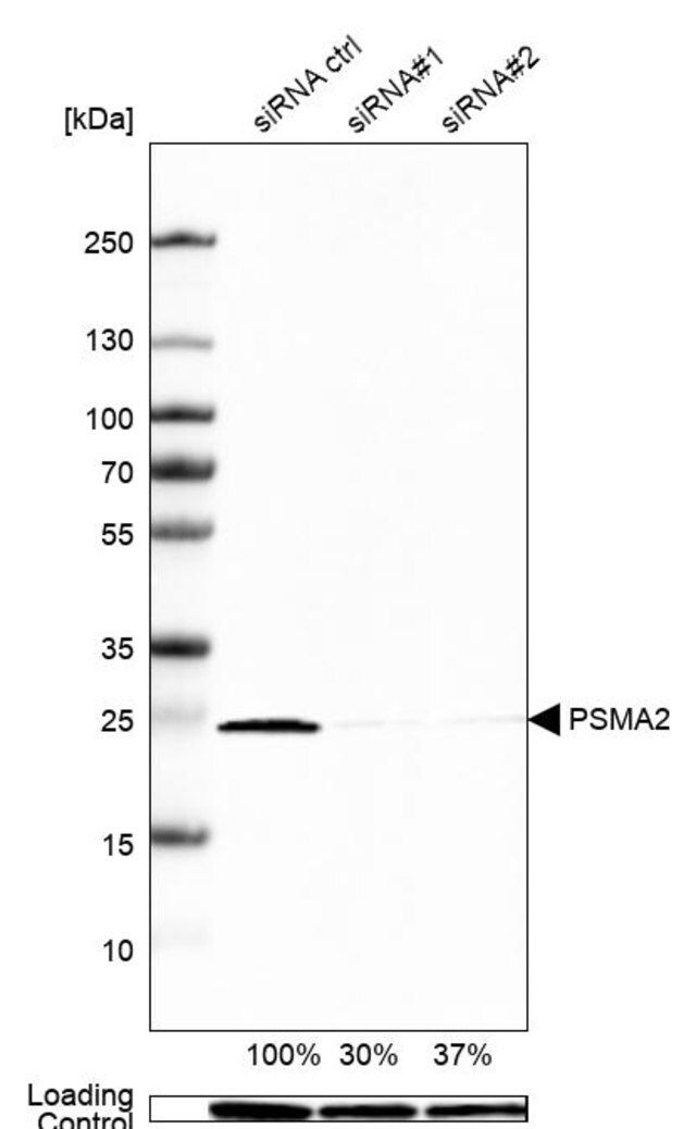 Anti-PSMA2 antibody produced in rabbit