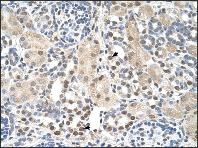 Anti-PSAT1 antibody produced in rabbit
