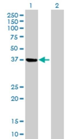 Anti-PSAT1 antibody produced in mouse