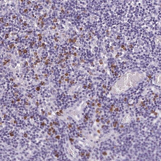 Anti-PSD antibody produced in rabbit