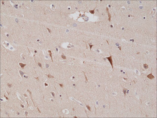 Anti-PSD-95 antibody, Rabbit Monoclonal