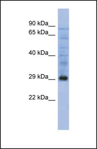 Anti-PSMA5 antibody produced in rabbit