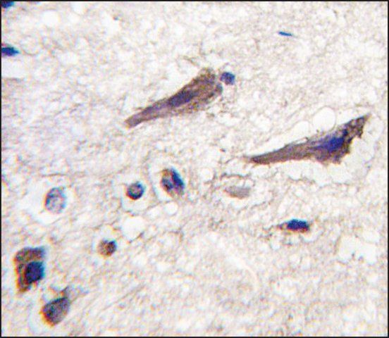 Anti-PSMA5 (center) antibody produced in rabbit