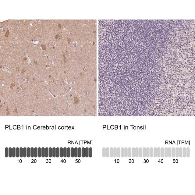 Anti-PLCB1 antibody produced in rabbit