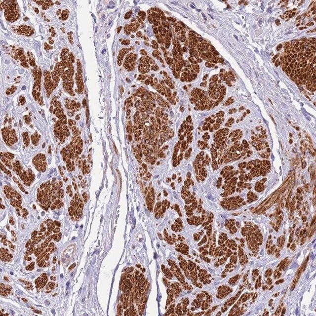Anti-PLEKHH1 antibody produced in rabbit