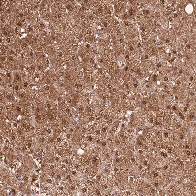Anti-PLPPR2 antibody produced in rabbit