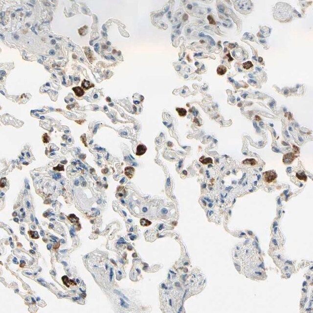 Anti-PLXNA1 antibody produced in rabbit