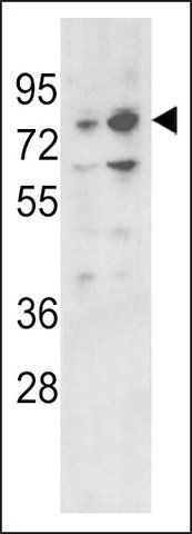 ANTI-PLZF(C-TERMINAL) antibody produced in rabbit