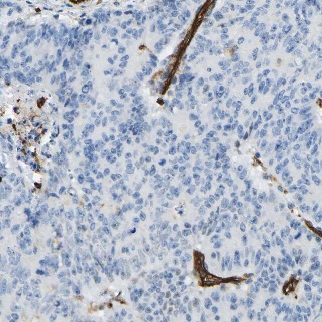 Anti-PLXDC1 antibody produced in rabbit
