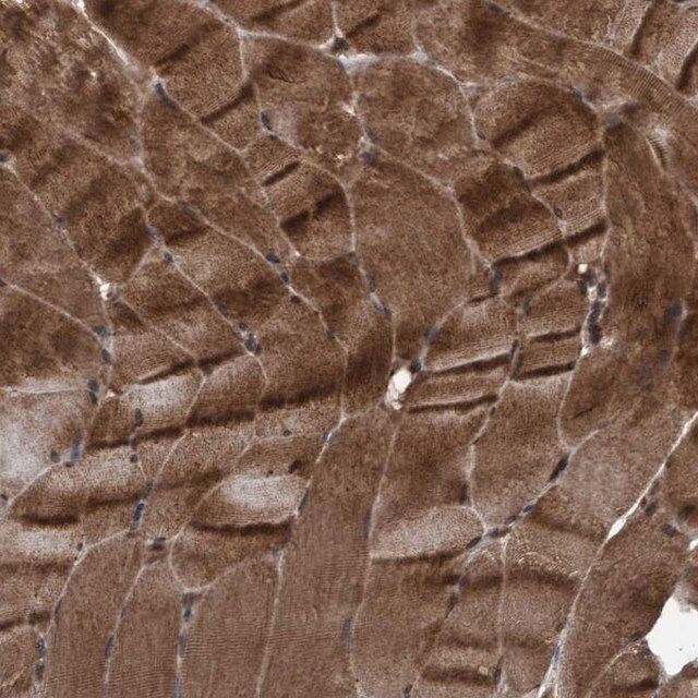 Anti-PLXNB2 antibody produced in rabbit
