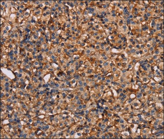 Anti-PLXNA1 antibody produced in rabbit