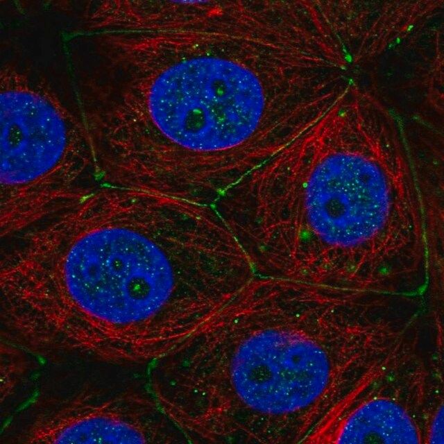 Anti-PLXNA3 antibody produced in rabbit