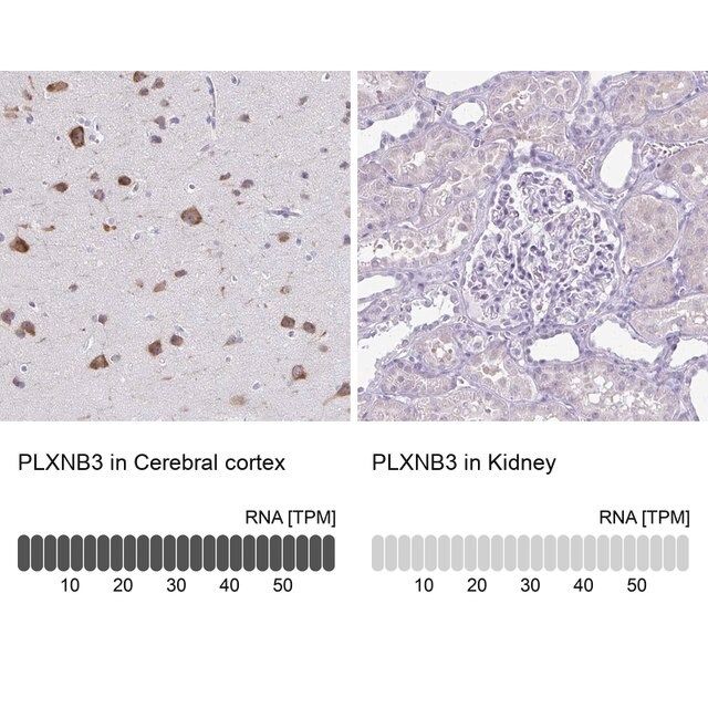 Anti-PLXNB3 antibody produced in rabbit