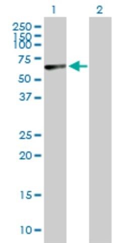 Anti-PNPLA2 antibody produced in mouse