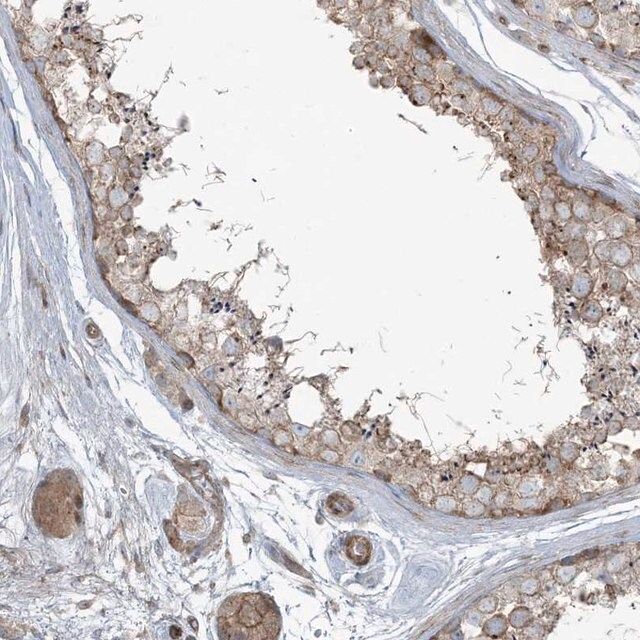 Anti-PIK3R4 antibody produced in rabbit