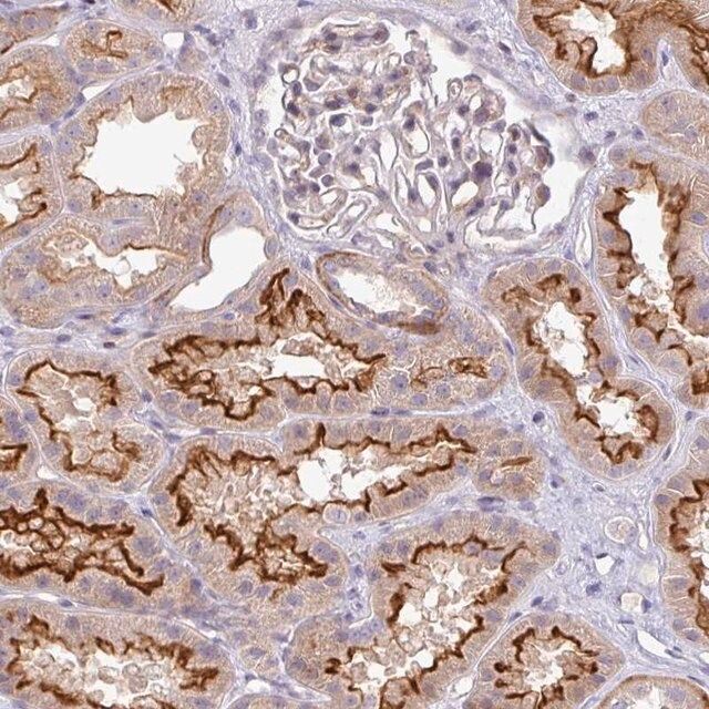 Anti-PIK3R5 antibody produced in rabbit