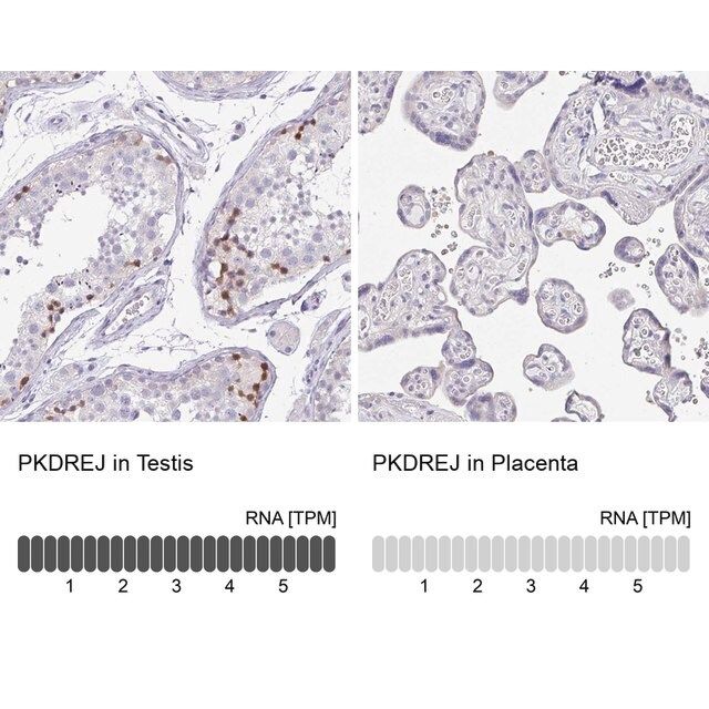 Anti-PKDREJ antibody produced in rabbit