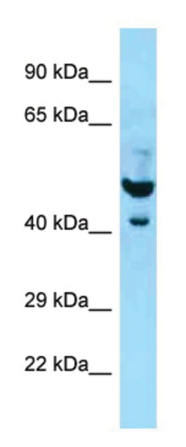 Anti-PLAUR (N-terminal) antibody produced in rabbit