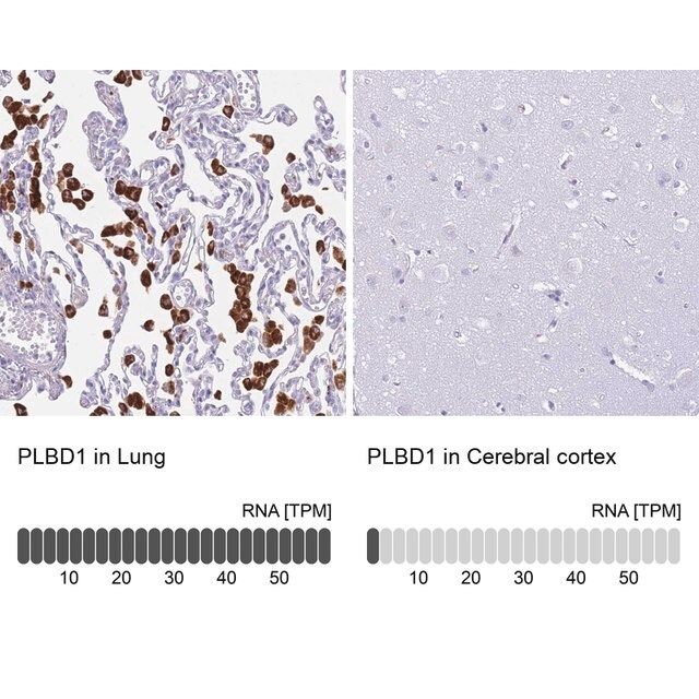 Anti-PLBD1 antibody produced in rabbit