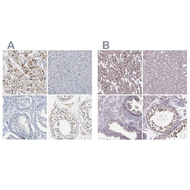 Anti-PKP2 antibody produced in rabbit