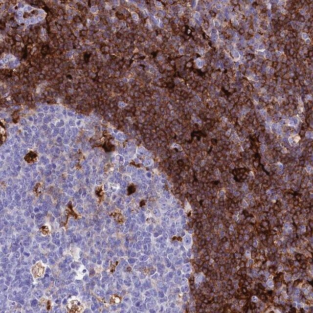 Anti-PLAC8 antibody produced in rabbit