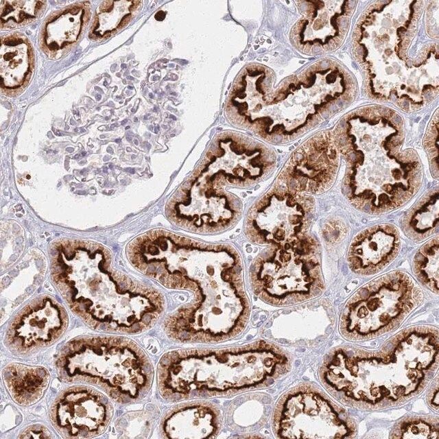 Anti-PKD2L2 antibody produced in rabbit