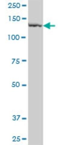 Anti-PLB1 antibody produced in mouse