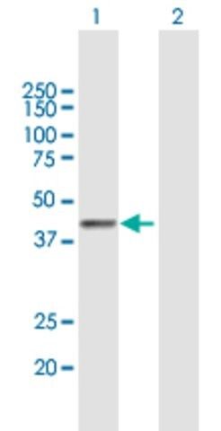 Anti-PLB1 antibody produced in mouse