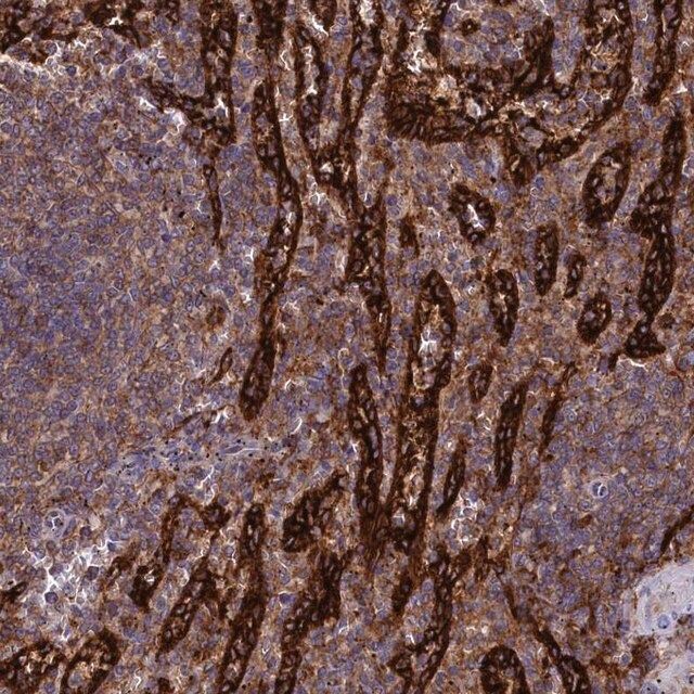 Anti-PLEKHO2 antibody produced in rabbit
