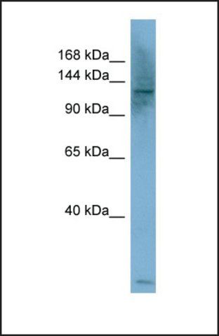 Anti-PLCB1 antibody produced in rabbit