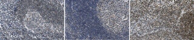 Anti-phospho-FKHRL1/FOXO3A (Thr32)