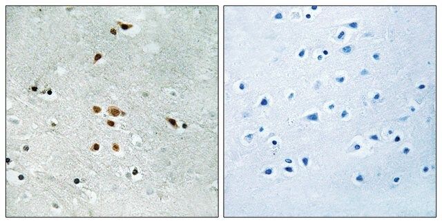 Anti-phospho-FER (pTyr<sup>402</sup>) antibody produced in rabbit