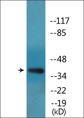 Anti-phospho-FOXL2 (pSer<sup>263</sup>) antibody produced in rabbit