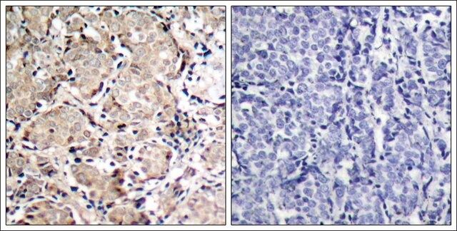 Anti-phospho-FOXO1 (pSer<sup>319</sup>) antibody produced in rabbit