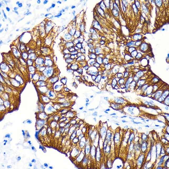 Anti-Phospho-GSK3β-S9 antibody produced in rabbit