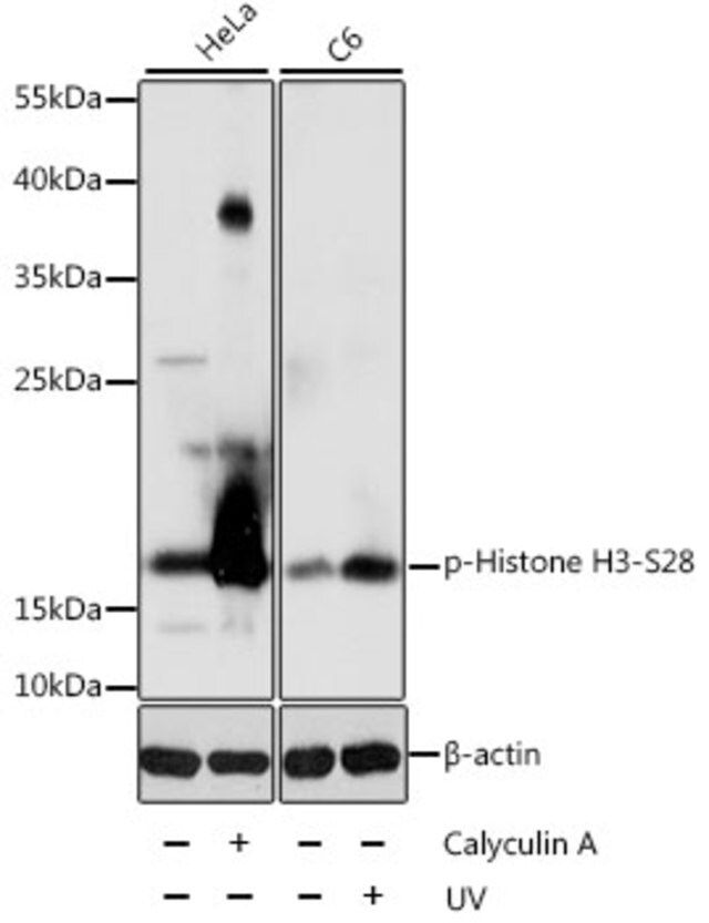 Anti-Phospho-Histone H3-S28 antibody produced in rabbit
