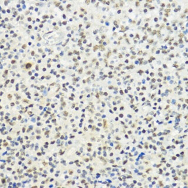 Anti-Phospho-Histone H3-T32 antibody produced in rabbit