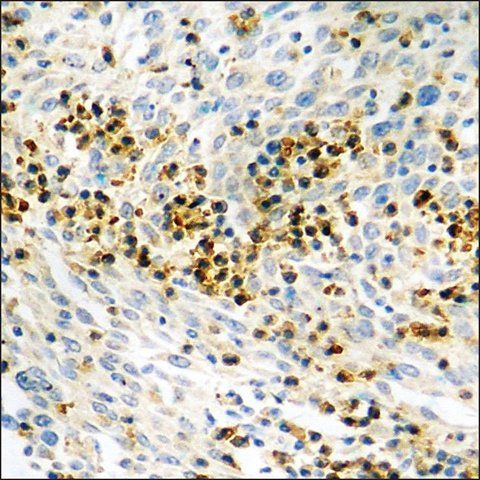Anti-phospho-HDAC8 (pSer<sup>39</sup>) antibody produced in rabbit
