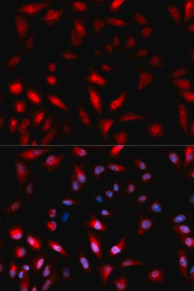 Anti-Phospho-HSP27/HSPB1-S82 antibody produced in rabbit
