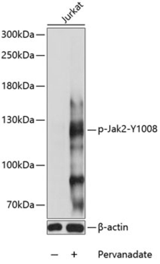 Anti-Phospho-Jak2-Y1008 antibody produced in rabbit