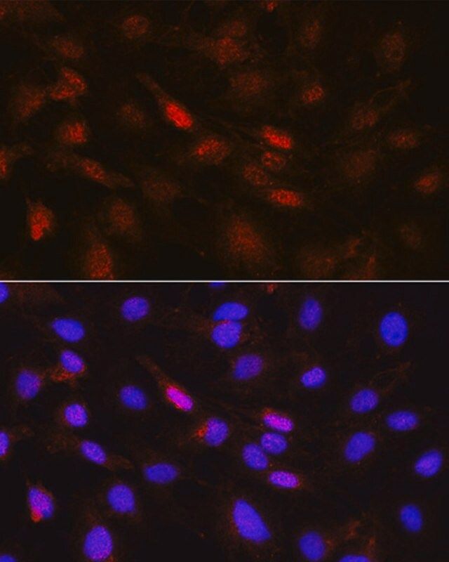 Anti-Phospho-Jak1-Y1022/1023 antibody produced in rabbit