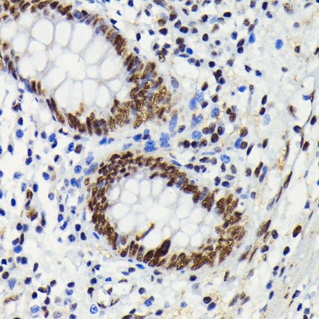 Anti-Phospho-JNK1/2/3-T183/T183/T221 antibody produced in rabbit