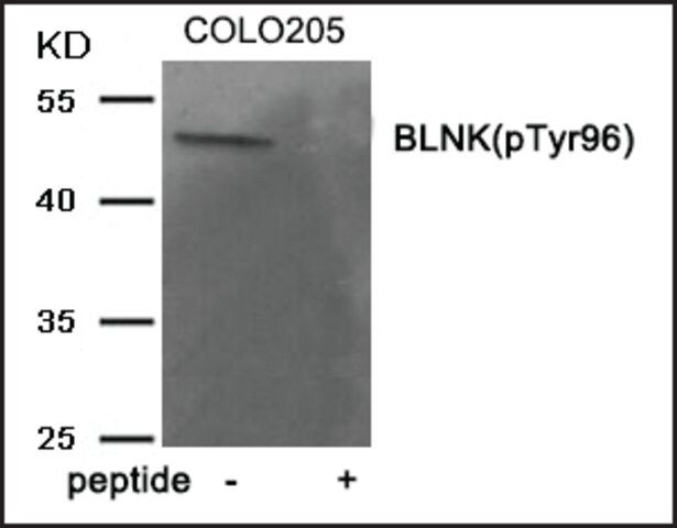 Anti-phospho-BLNK (pTyr<sup>96</sup>) antibody produced in rabbit