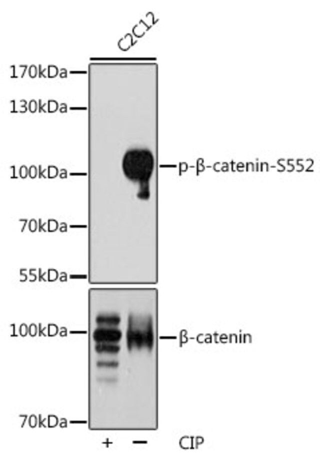 Anti-Phospho-beta Catenin-S552 antibody produced in rabbit