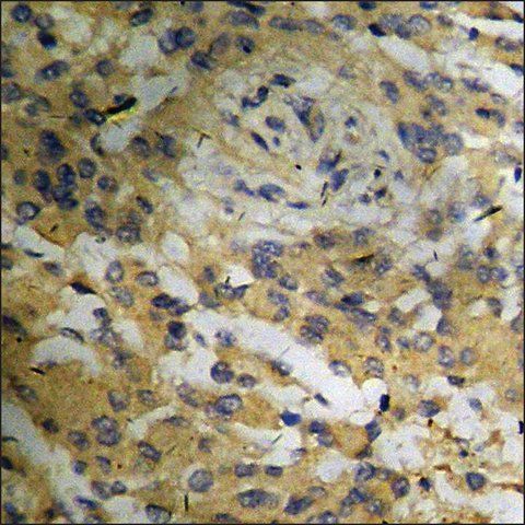 Anti-phospho-Bloom Syndrome (pThr<sup>99</sup>) antibody produced in rabbit