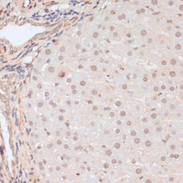 Anti-Phospho-BRCA1-S1423 antibody produced in rabbit