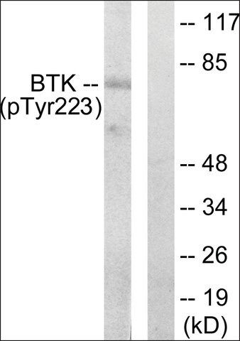 Anti-phospho-BTK (pTyr<sup>223</sup>) antibody produced in rabbit