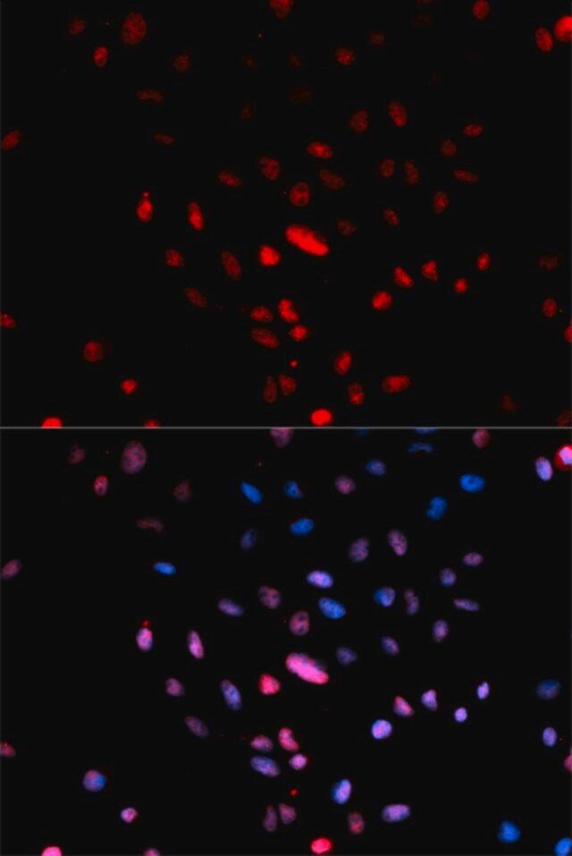 Anti-Phospho-c-Jun-S73 antibody produced in rabbit